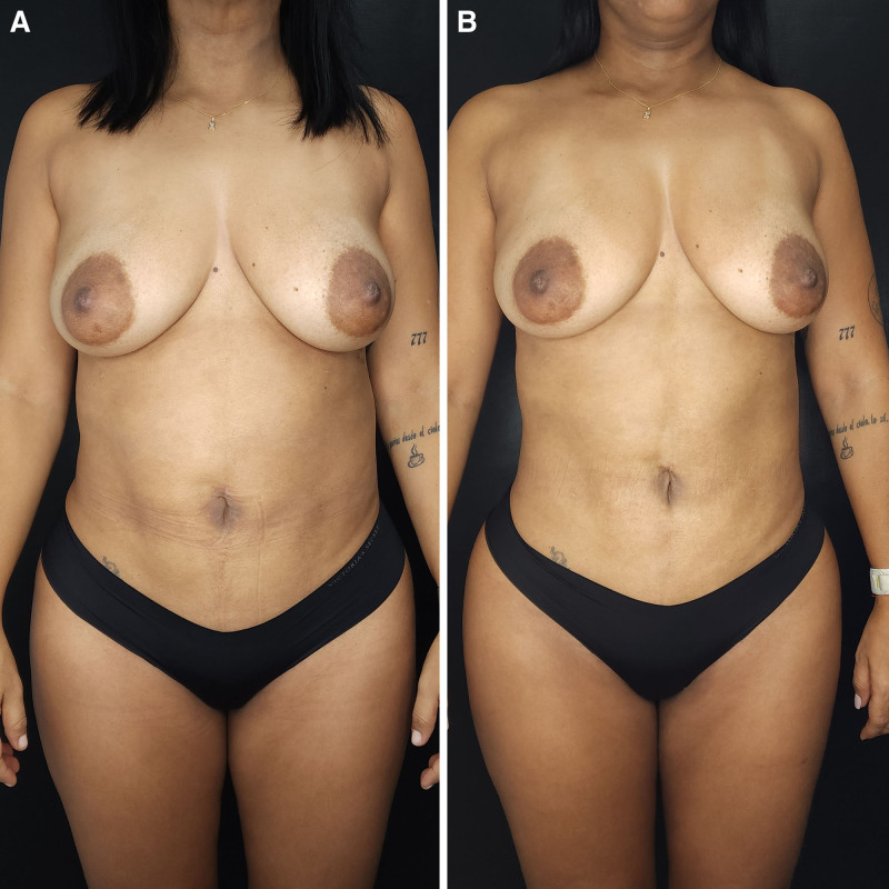Fig. 7.