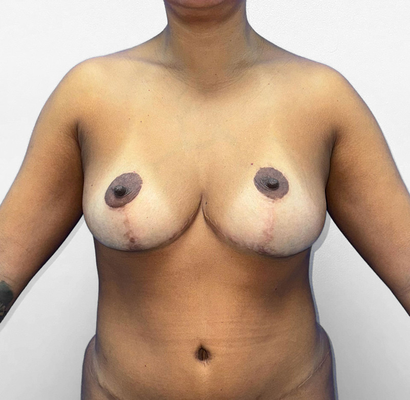 Fig. 12.