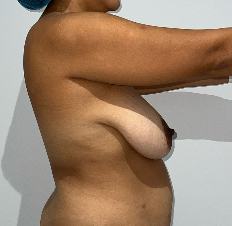 Fig. 13.