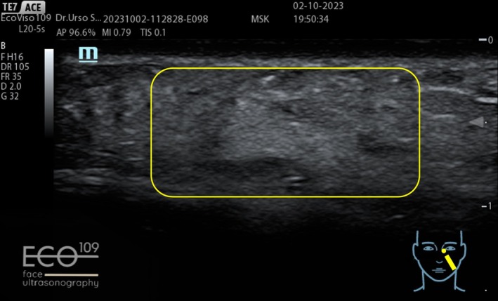 FIGURE 16