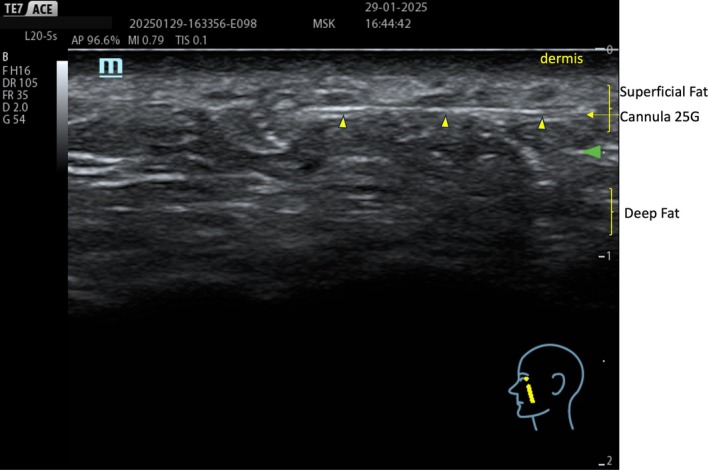 FIGURE 9
