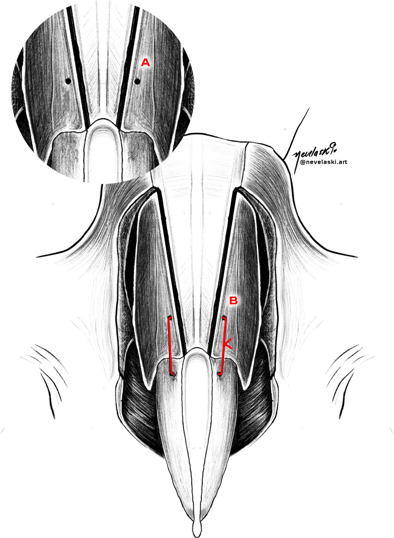 Fig. 10.