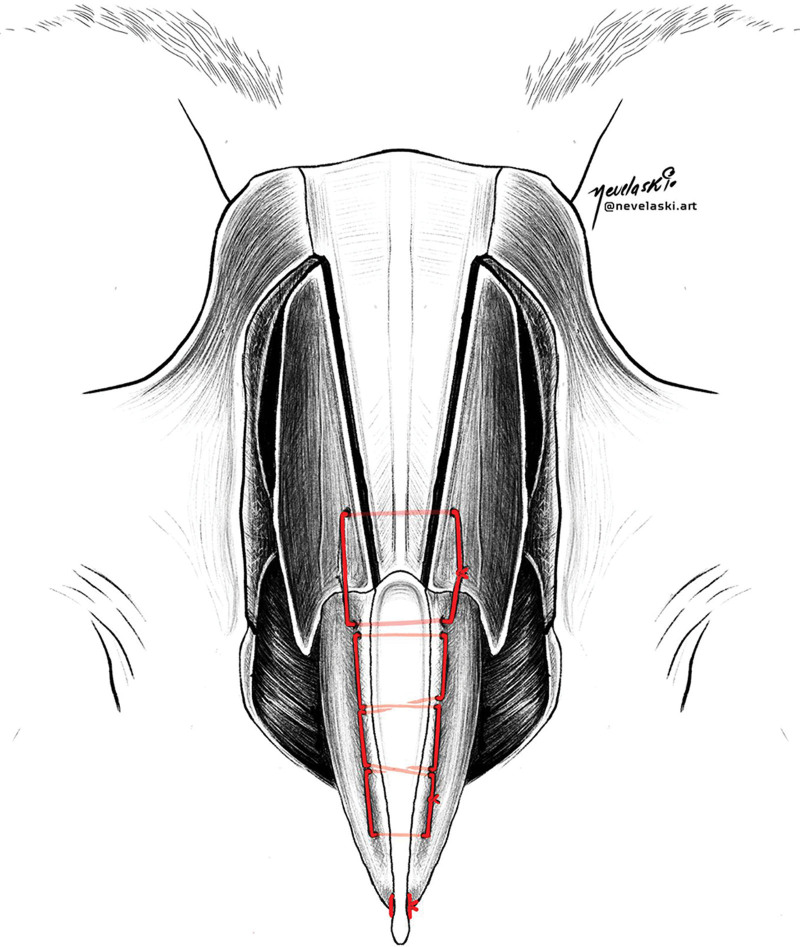 Fig. 18.