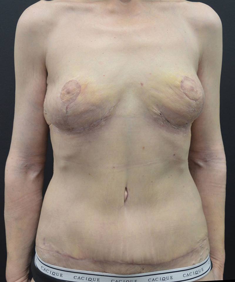 Fig. 12.