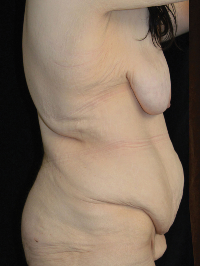 Fig. 13.