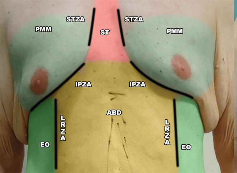 Fig. 3.