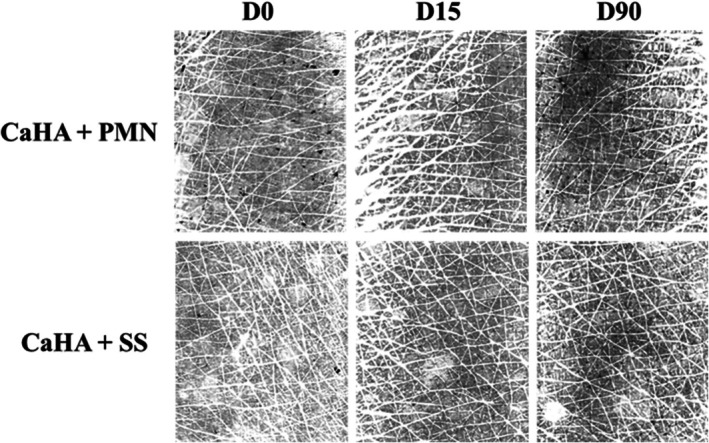 FIGURE 11