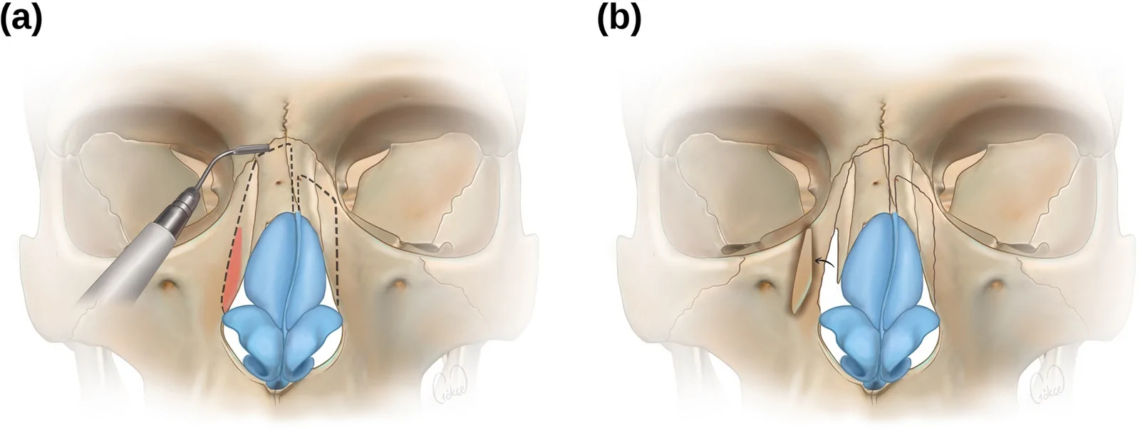 Fig. 6