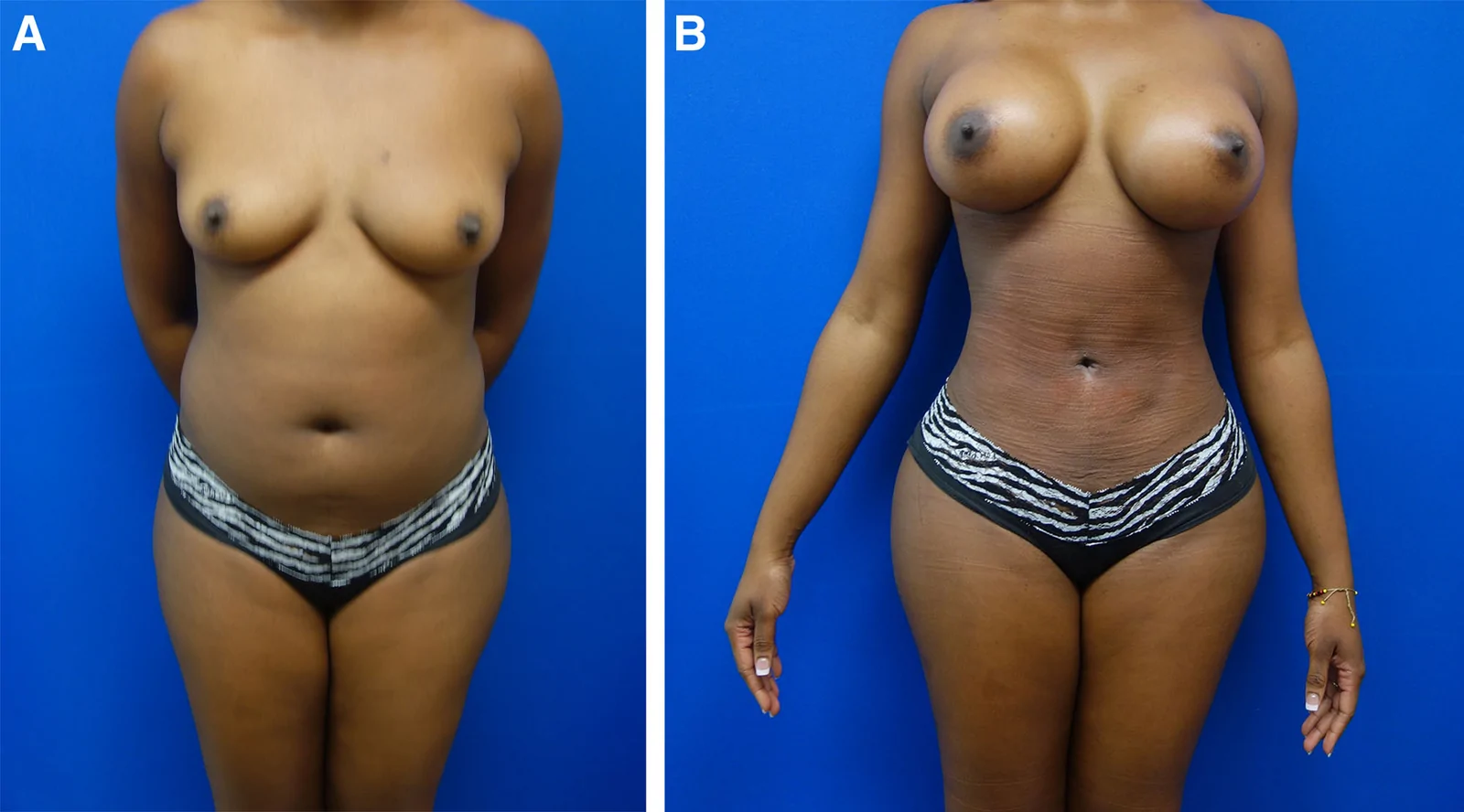 Fig. 6.