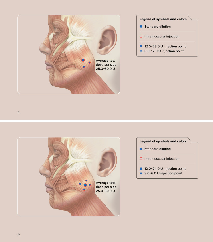 Fig. 11