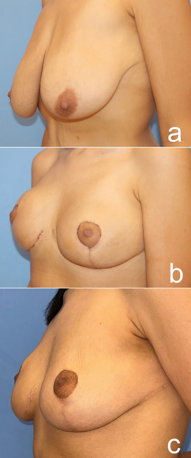 Fig. 17