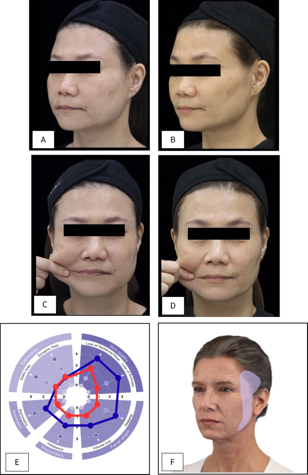 FIGURE 11
