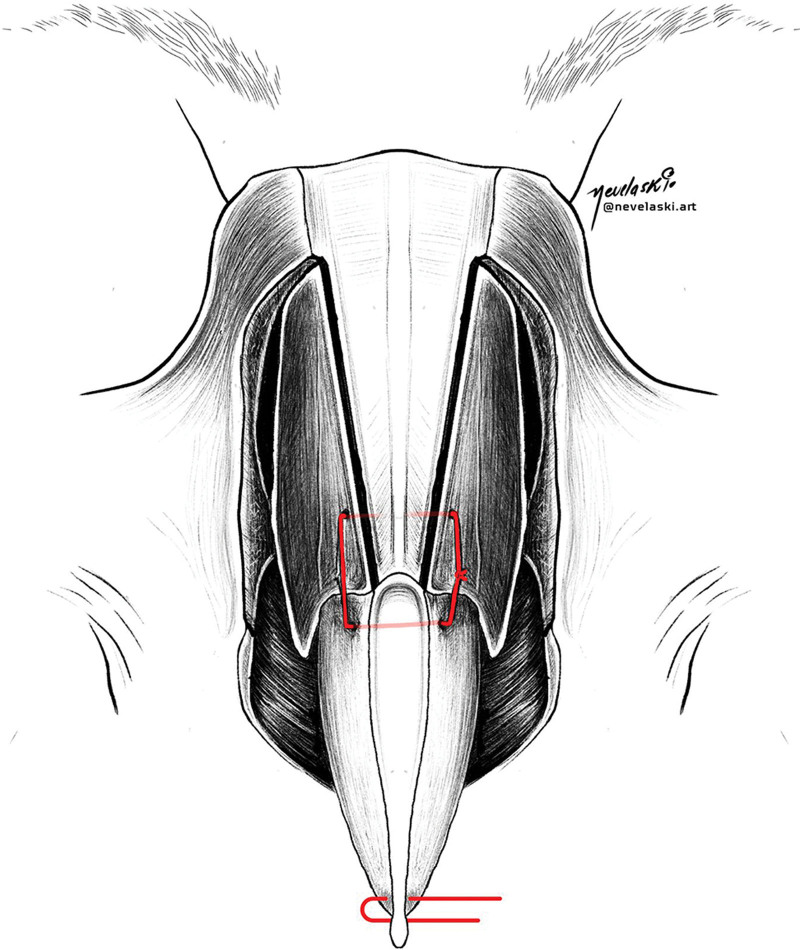 Fig. 14.