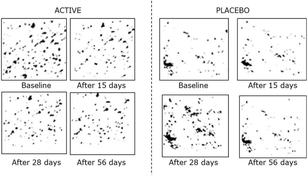 FIGURE 12