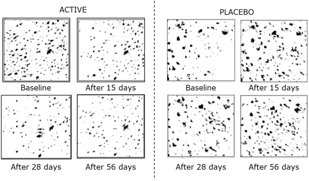 FIGURE 11
