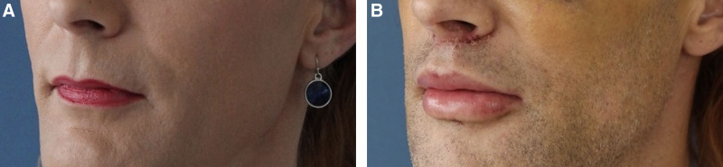Fig. 9.