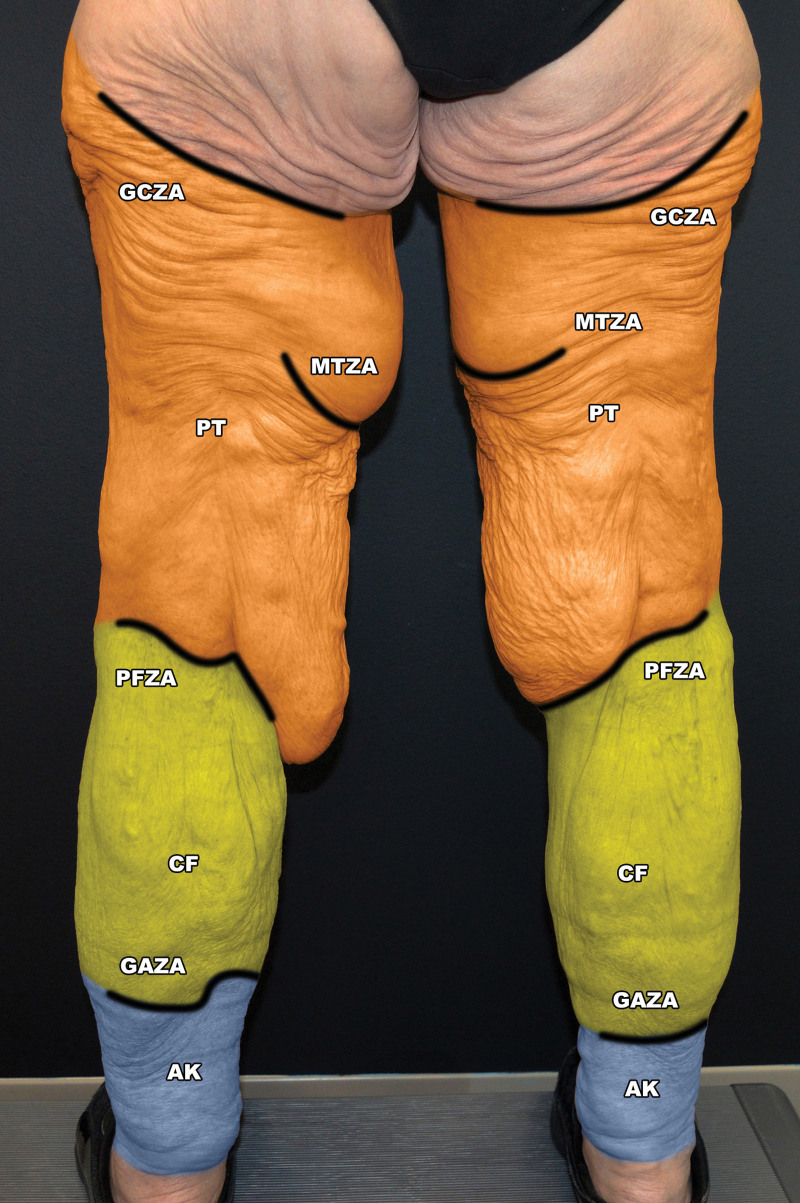 Fig. 10.