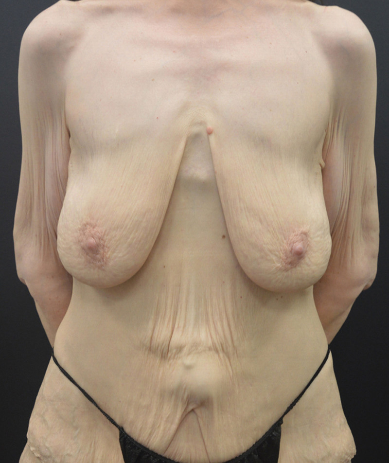 Fig. 11.