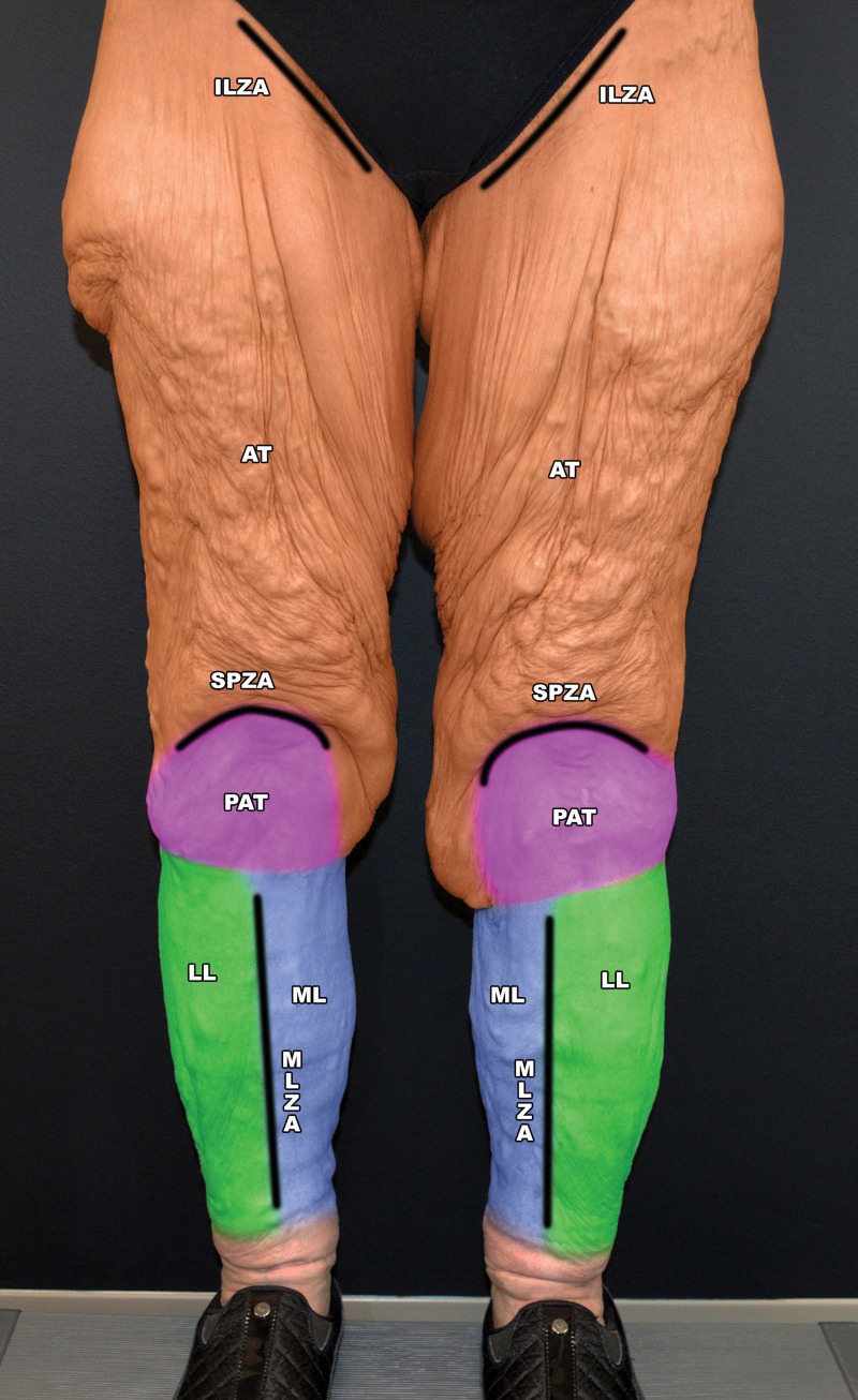 Fig. 9.