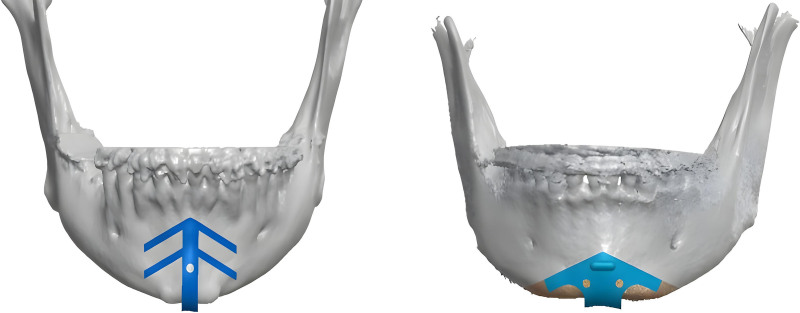 Fig. 3.