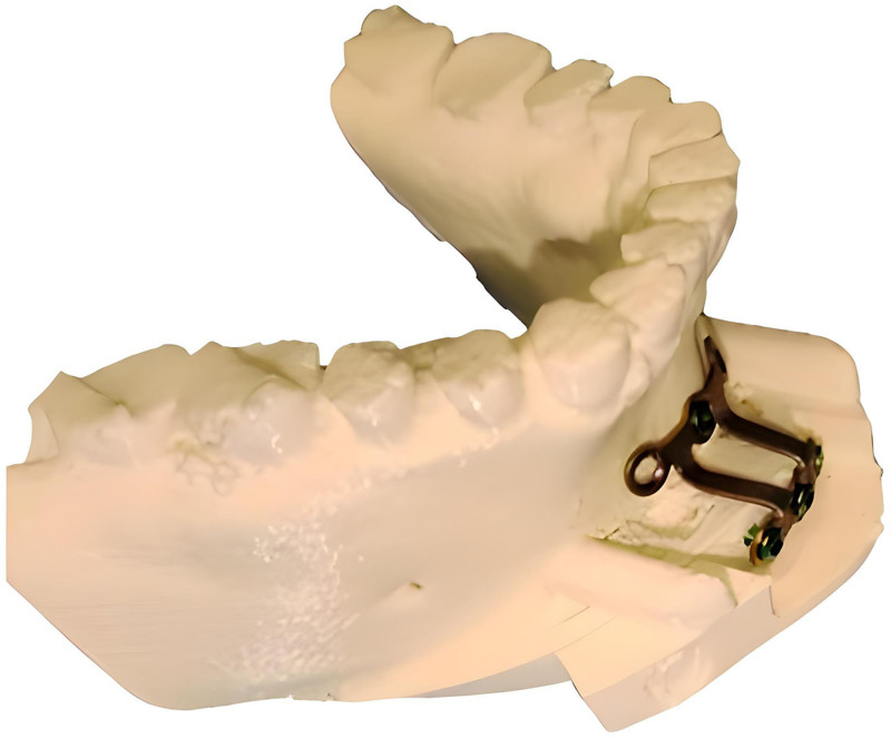 Fig. 5.