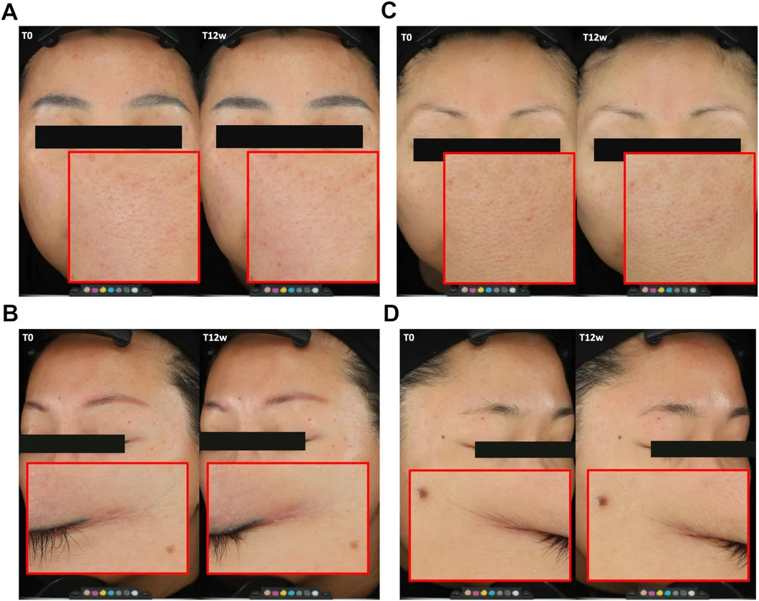 FIGURE 4