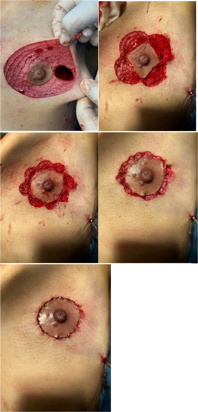 Fig. 4