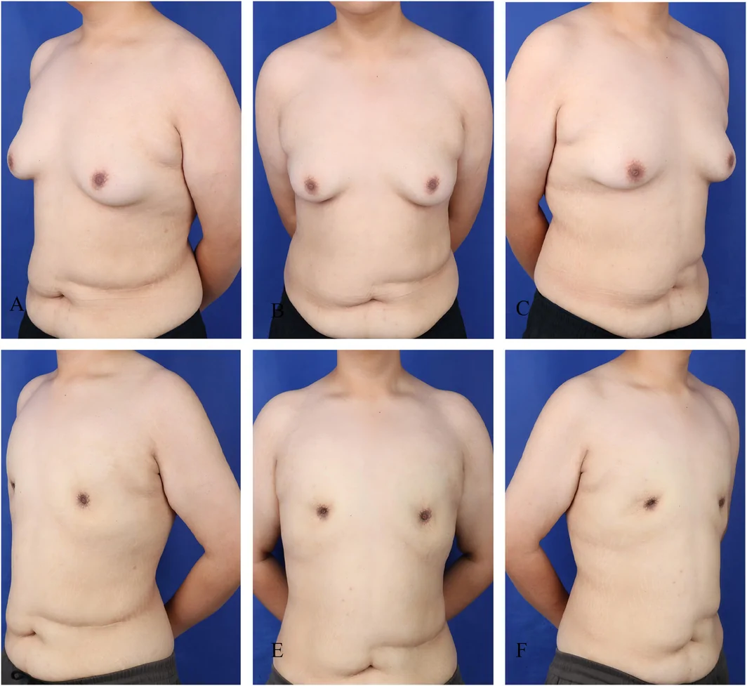 FIGURE 4