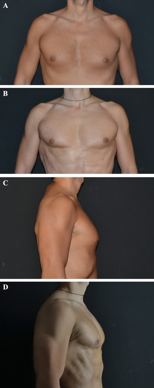 Fig. 3