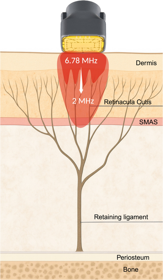 Fig. 6