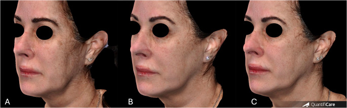 Fig. 9