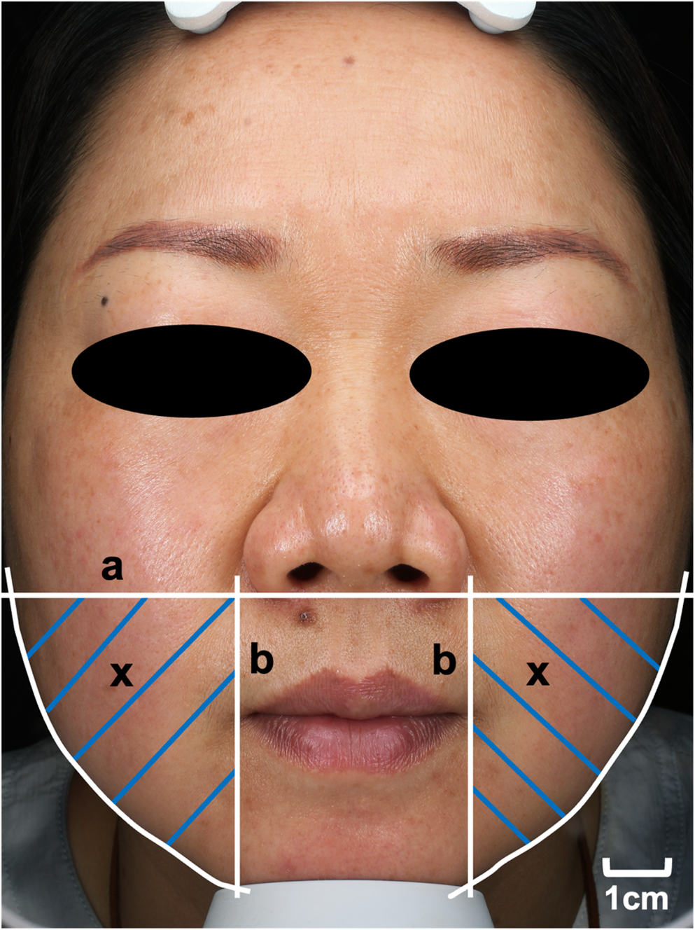Figure 2:IGAIS评分变化